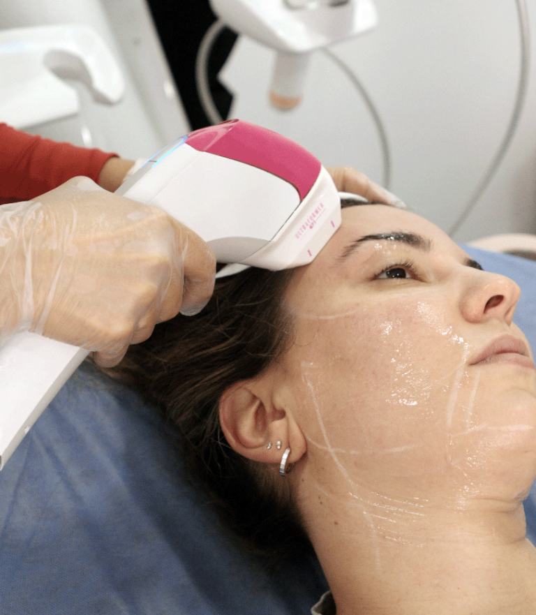 Tecnología Ultraformer MPT