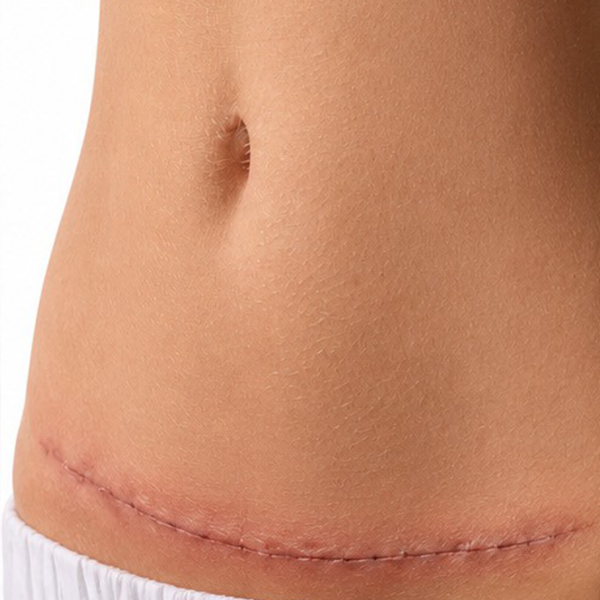abdomen